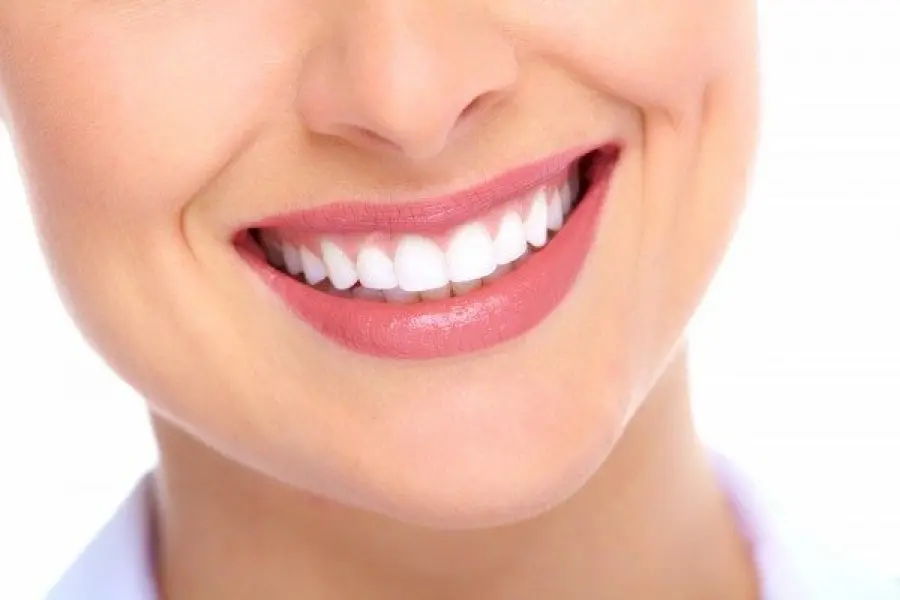 Macchie sui denti e ingiallimento: consigli e rimedi