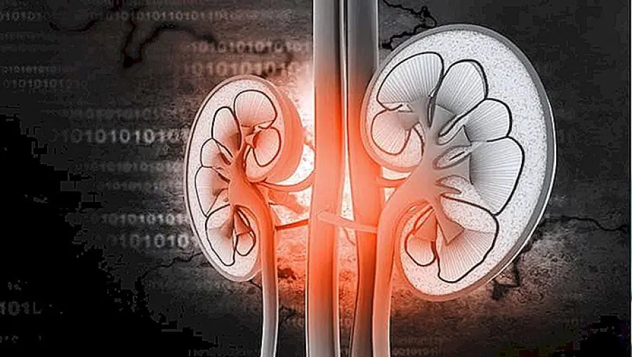 Cos'è la Pielonefrite?