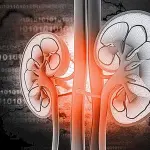 Cos'è la Pielonefrite?