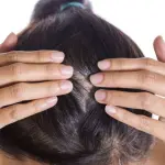 Psoriasi al cuoio capelluto: cause e rimedi